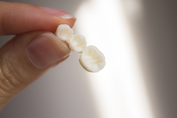 Dental Bridges Vs  Implants: Which Option Is Right For You?